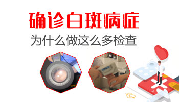 白斑黑皮肤